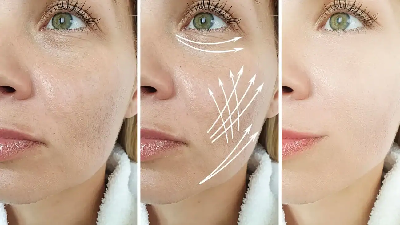 Can One Treatment Really Tackle More Than One Skin Concern Tilehurst?