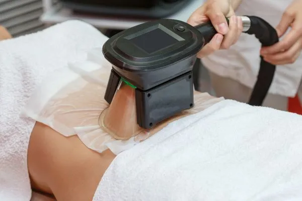 Image of person having fat freezing treatment to help weight gain Tilehurst