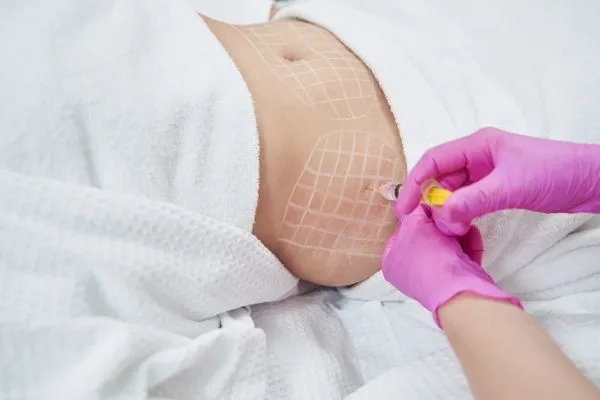 image of fat dissolving injections on love handles to help combat weight gain Tilehurst