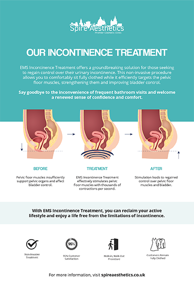 image to show how EMS treatment works for female urinary incontinence Tilehurst
