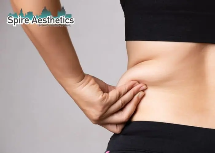 Image of woman pinching fat on their hips Tilehurst. Fat Freezing treatment