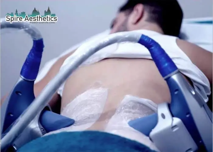 Man having fat freezing treatment done on love handles before a competitions Tilehurst to create a sculpted look.