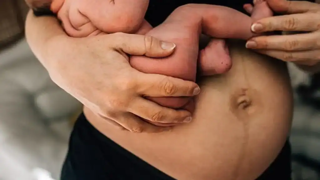 Why Is My Stomach Still Big After Pregnancy Tilehurst?