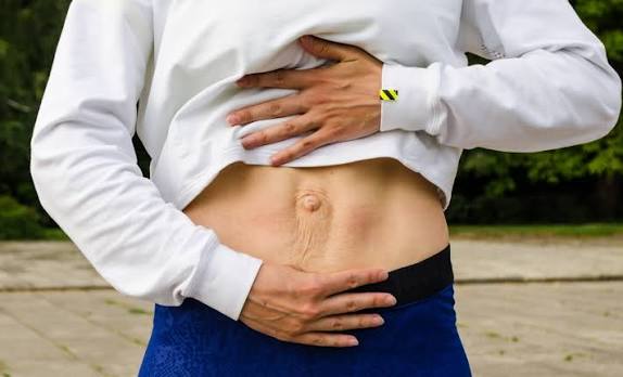 When Could Diastasis Recti Be the Missing Piece of the Puzzle Tilehurst?